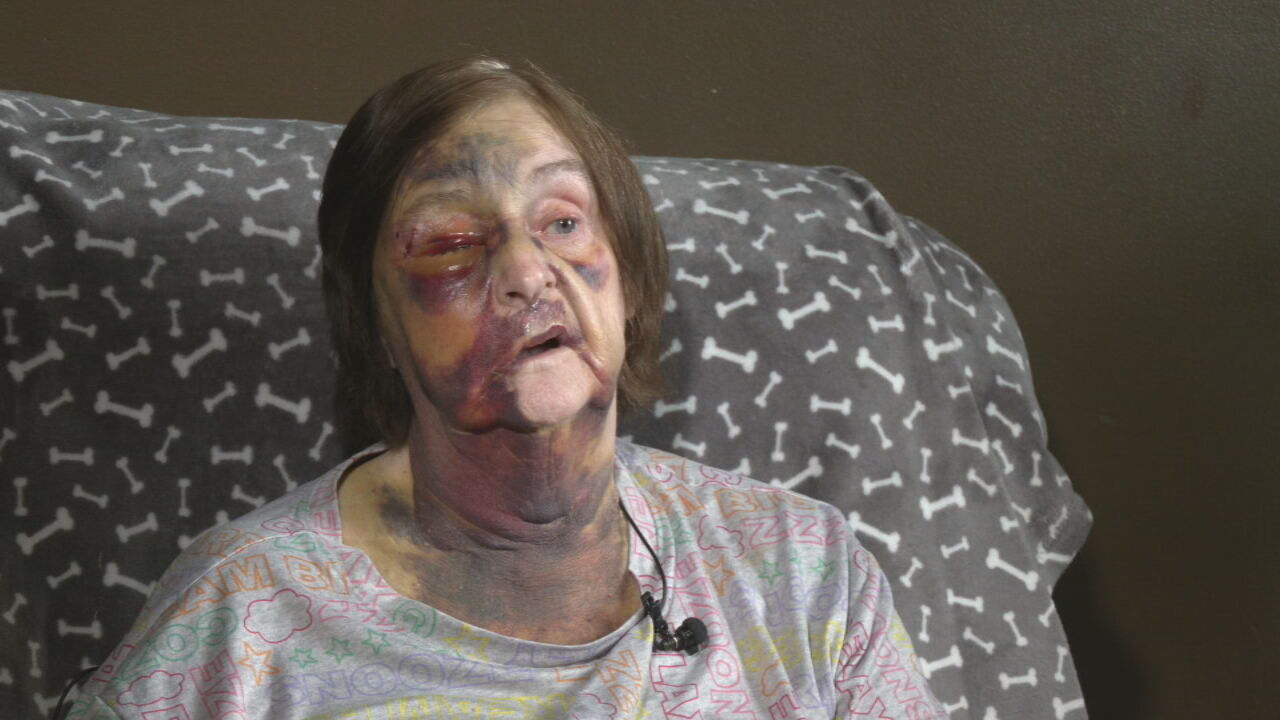 NELSON COUNTY ELDERLY ASSAULT (1).jpeg